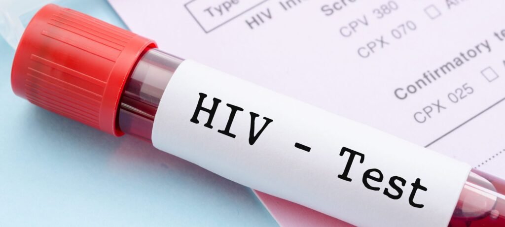 covid aids
