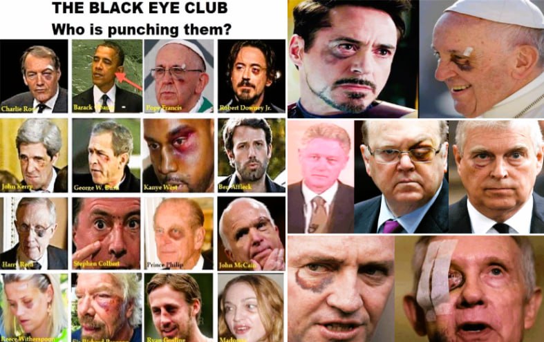 Black eye club