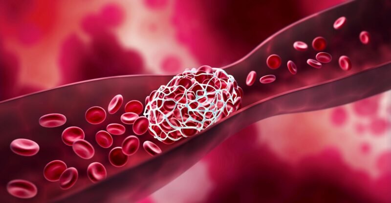 vaxx clots 